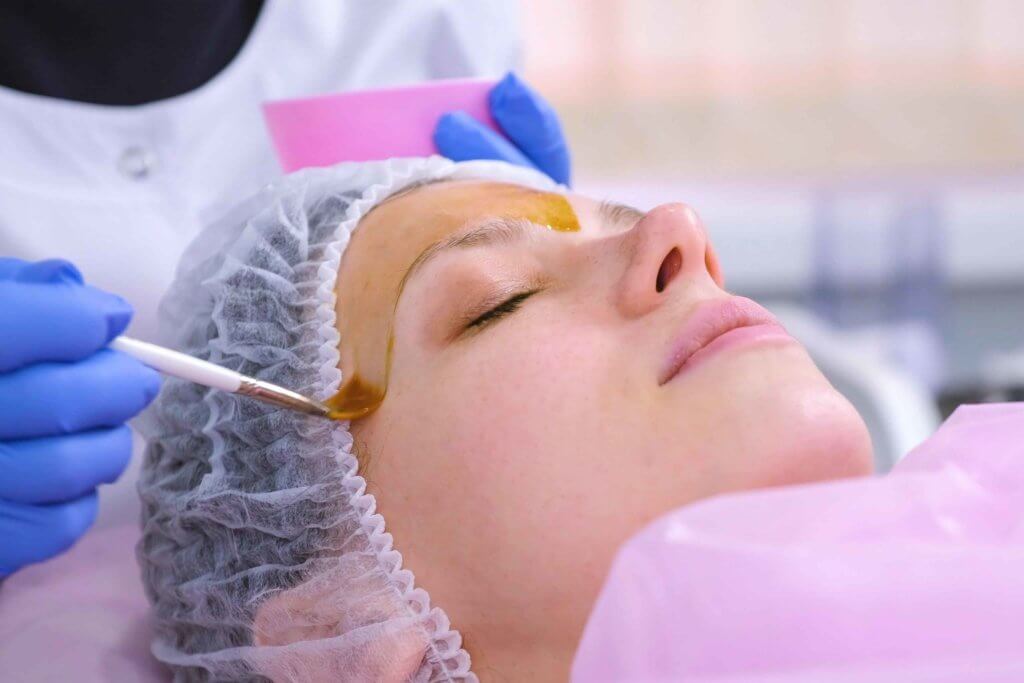 Chemical Peels in Plano TX by Couture Dentistry