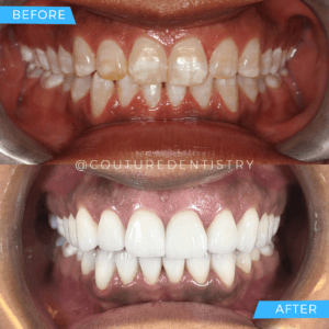 Before and After Treatment image 5| Cosmetic Dentistry