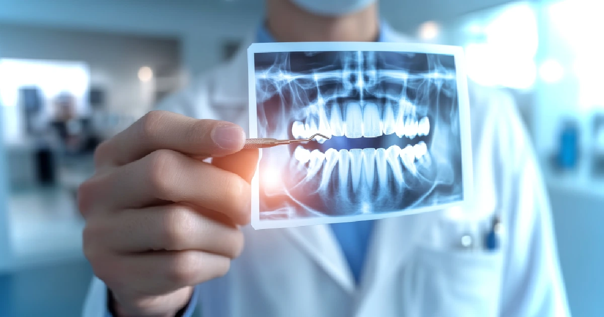 Dentist holding a dental X-ray for preventive dentistry in Plano TX
