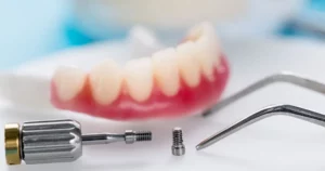 Woman gently touching her cheek and smiling, signifying comfort and confidence gained from full-mouth dental implants