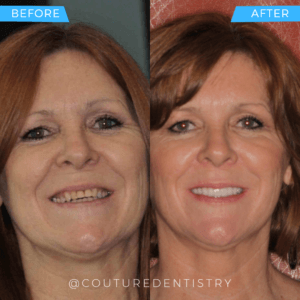Before and After Treatment image Cosmetic Dentistry